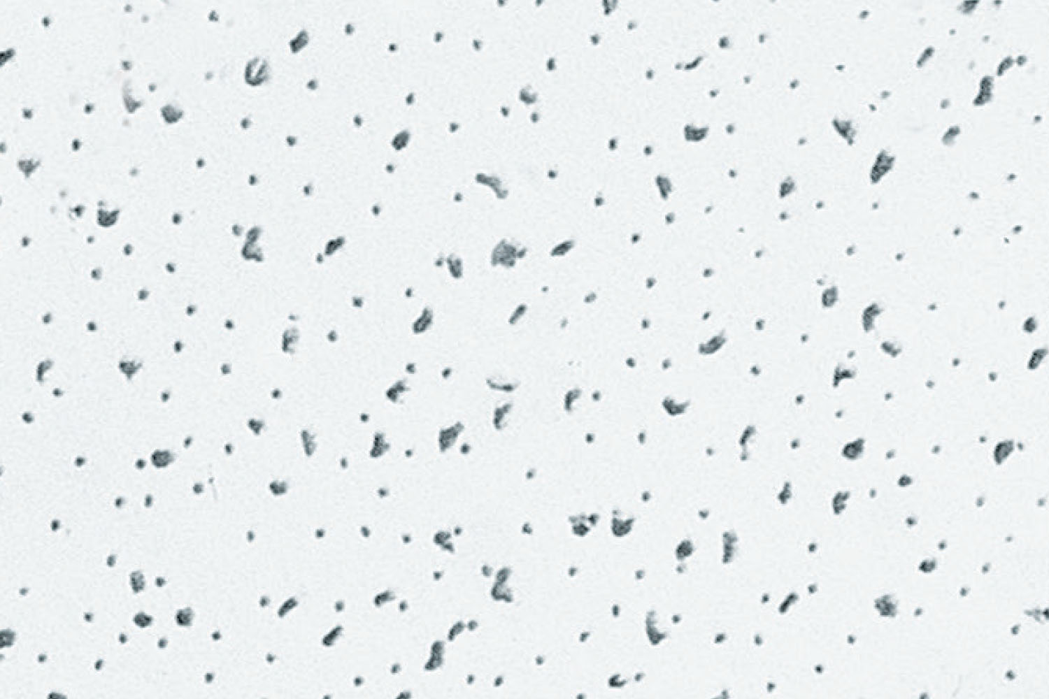 أسقف رادار™ الصوتية